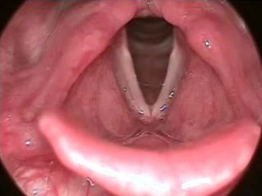 A close-up of a person's mouth

Description automatically generated with medium confidence